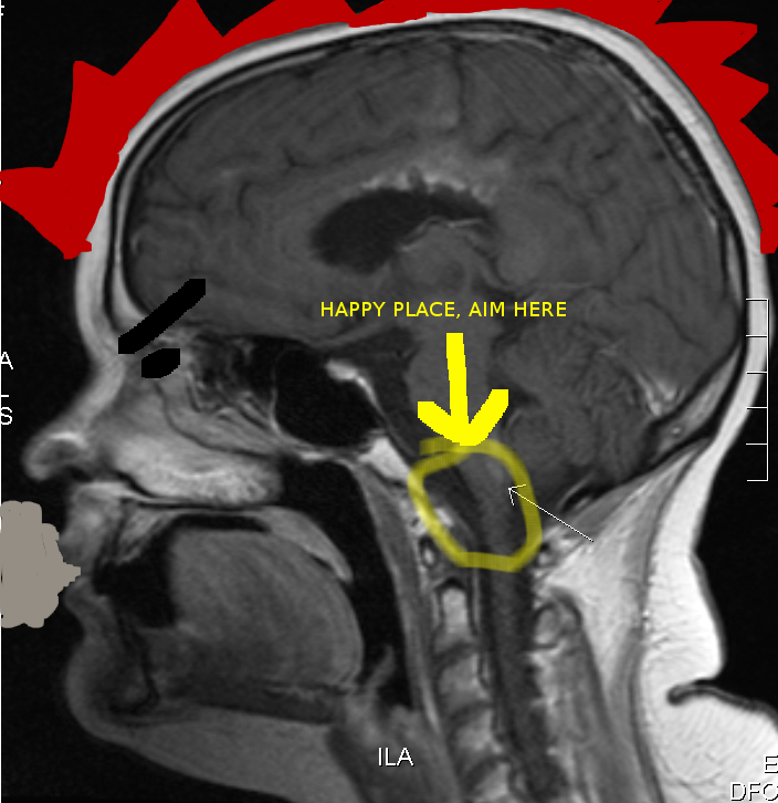 ngH.jpg